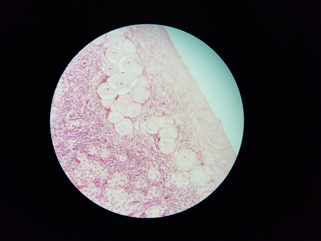 Ovary Slides - Ovary 012 400X